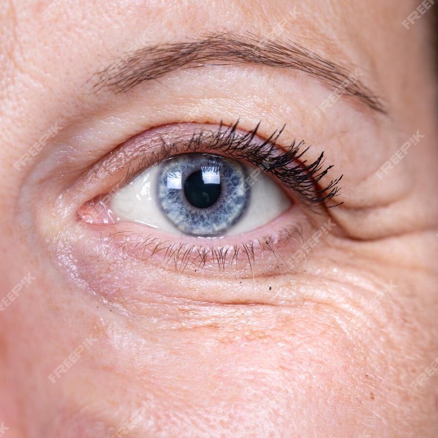 1. 보톡스 Before Image