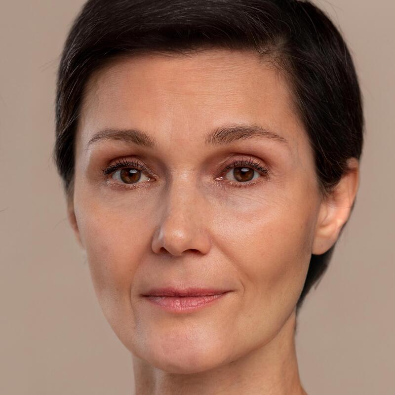 2. 보톡스 After Image